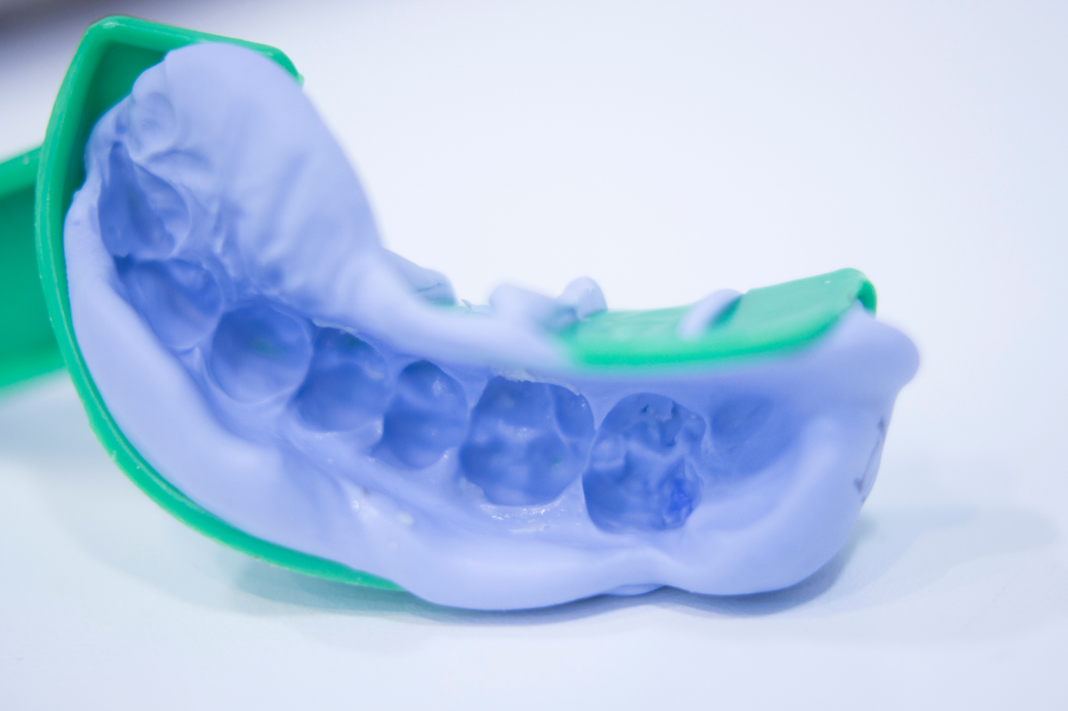 3 Reasons for a CustomMade Mouthguard Kelmscott Dental